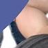 Apprehension Crank Test For Anterior Shoulder Dislocation Shoulder Instability