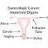 I Have Gyn Cancer How Do I Know Which Treatment Is Right For Me