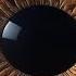 Iris Anatomy Iris Physiology Eye Anatomy