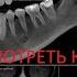 Узнайте как просматривать КТ зубов дома Программы для просмотра КТ и МРТ Формат DICOM