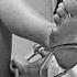 Аборт методом вакуум экскохлеации Abortion By Vacuum Excretion
