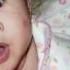 Aldey