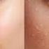 Саблиминал на красивую чистую кожу Subliminal For Beautiful Clear Skin