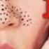 Solutions To Undying BLACKHEADS