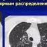 Александр Аверьянов Все что нужно знать про COVID 19