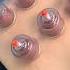 The Secret Behind Cupping Therapy Shorts