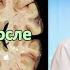 Избежать болезнь Альцгеймера и ВЫЛЕЧИТЬ деменцию О чем врет ваш врач 8 часть