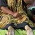 Heboh Wanita Ini Kakinya Berubah Menjadi Kaki Sapi