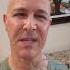 Erase Dark Spots Now Dr Mandell