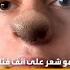 حديث السوشال عضة كلب تتسبب في نمو شعر على أنف فتاة