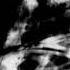 Exci Ultravision Another 145BPM Genre Hard Trance Korea BMS Primrose BMS