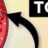 10 Tips To Clear Blood Clots Naturally
