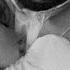 DNDM Mirjalol Nematov Bir Sher Yozdim DNDM Remix