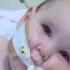 Alexandria The First One To SMA Drug