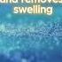 Garyaev S Sound Matrix Cleaning Of Lymph And Getting Rid Of Swelling Garyaev