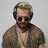 Gian Nobilee Live Sunburn At Home