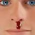 If Your Nose Starts To Bleed