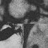 Misanthropy