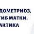 Миома в матке эндометриоз киста яичника загиб матки Лечение и профилактика болезней матки