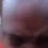 Damn Look At My Forehead