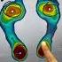 This Is What You Didn T Know About The Albert 2 Pro Scanner Aetrex Technology Shorts Foot Scan