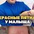 Красные пятна у малыша материнство родители дети мама семья роды