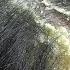 DRY SCALP Big Flakes Dandruff Scratching 37