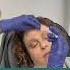 Neurotoxin FAQ