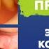Больно жевать с зубным протезом Экзостозы Ксеростомия Атрофия челюстей