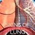 Signs Of Lung Cancer Shorts Lungs Lunghealth