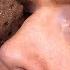 Ice Cream Sandwich In Eye