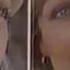 CBS And ABC Commercials 1978
