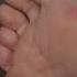 Wrinkled Soles And Toes Closeup