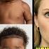 White Couple Fled Black Sextuplets At Birth Years Later The Outcome Is Shocking