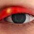 What S REALLY Causing Your Eye Stye Shorts Viralvideo Creativelearning3d