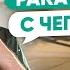 Лечение рака яичников С чего начать Онкогинекология
