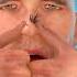 STOP Squeezing Blackheads Try This Safe Effective Method Instead Shorts