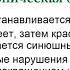 Неврология Эпилепсия