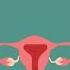 5 CAUSES OF BLEEDING AFTER SEX