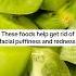 These Foods Help Get Rid Of Facial Puffiness And Redness Facialpuffiness Redness Skincare Usa
