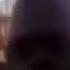 Damn Look At My Forehead